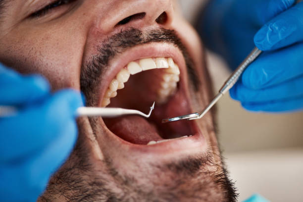 Emergency Dentist for Kids in CA
